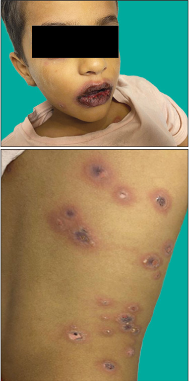 Clinical Infectious Diseases Society Update Book 2025