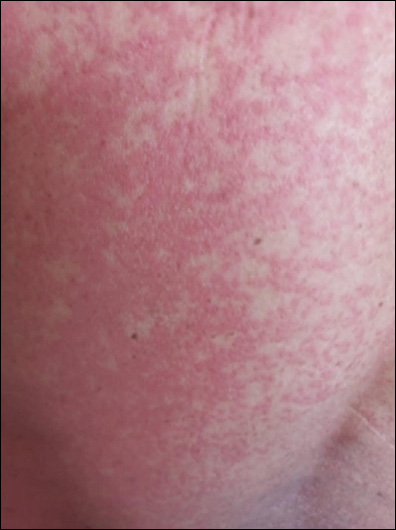 Clinical Infectious Diseases Society Update Book 2025